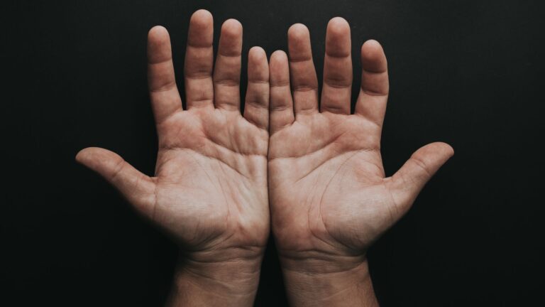 Left Hand Palm Itching, Is It a Good Omen? What You Need to Know